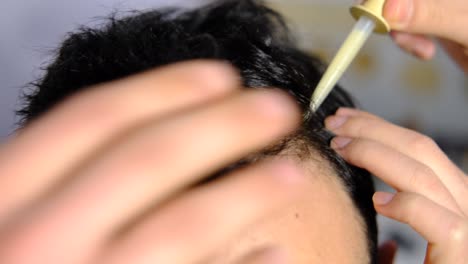 tratamiento de la pérdida de cabello