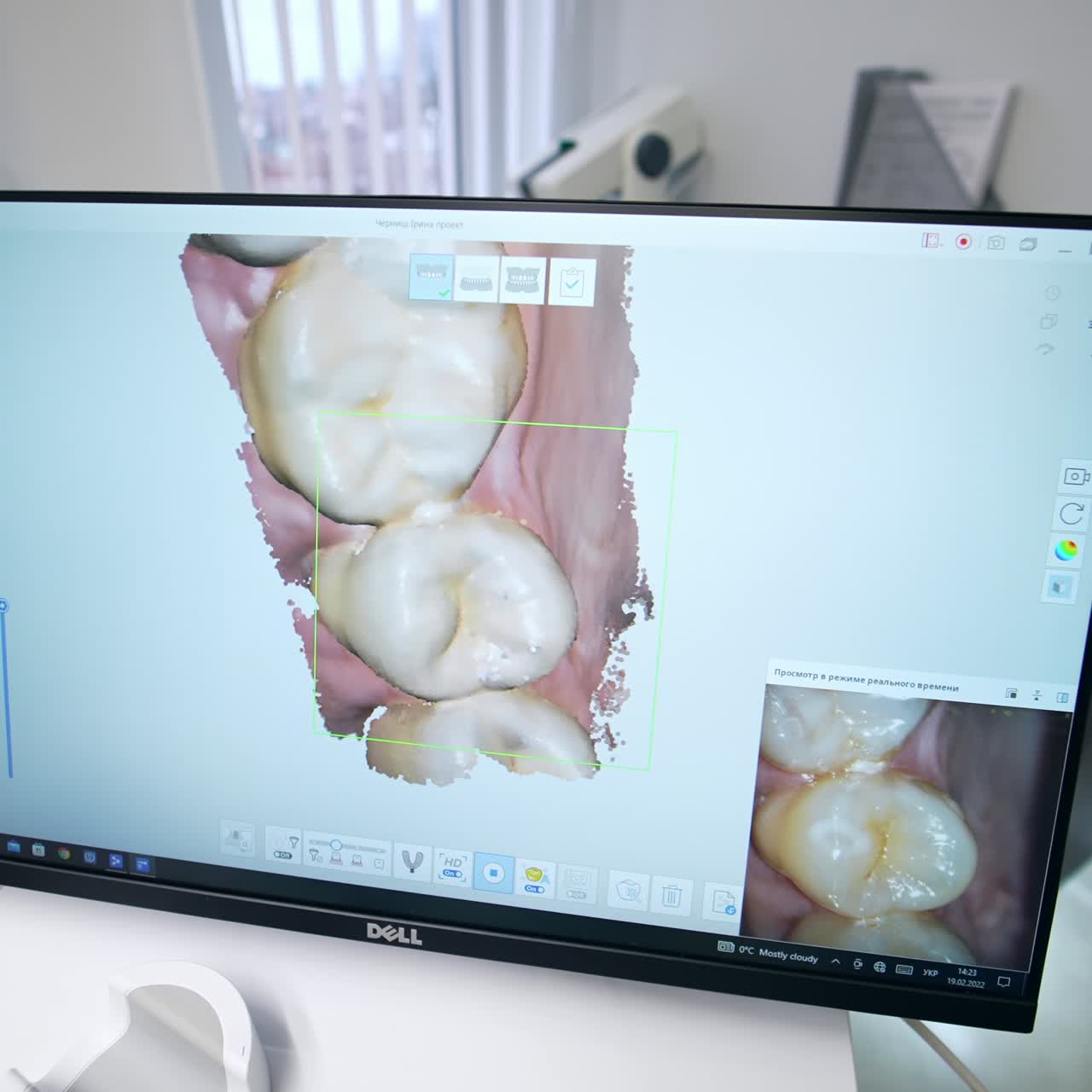 Large screen showing the micro shot of patient's teeth. Close up. Equipment in the modern dentistry cabinet of dental clinic