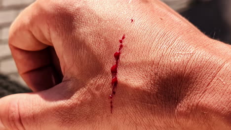 detailed close-up of a fresh cut on a man's hand, showing raw skin and light bleeding.