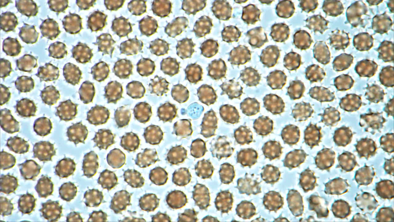 Microscopic View of Spiky Cells or Pollen with a Blue Anomaly