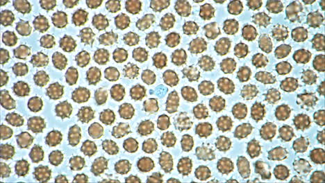 microscopic view of spiky cells or pollen with a blue anomaly