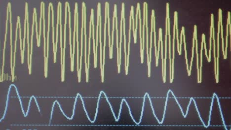 a hospital heart monitor monitor a baby inside of it's pregnant mother that is currently in labor