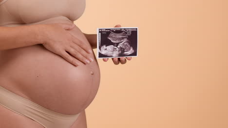 pregnant woman holding fetal ultrasound