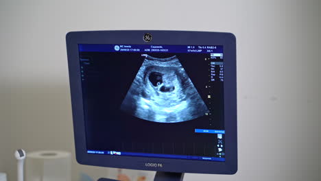 sonographer using ultrasound machine at work. professional doctor screening of patient by ultrasound