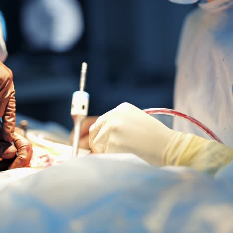 hands of professional neurosurgeons provide operation with special equipment and instruments. modern operation room with bright light