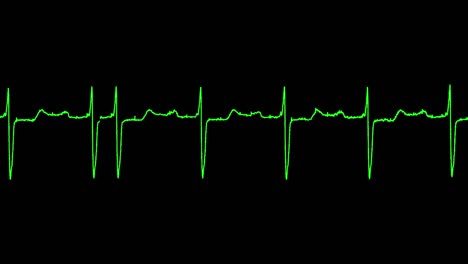 ecg shows first degree av block arrhythmia