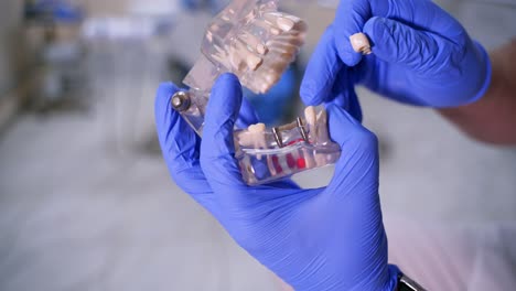doctor shows fake implants on a plastic jaw sample or model. modern dental clinic background. blue medical gloves on doctor's hands. dental hygiene and health concept video. implants in jaw.