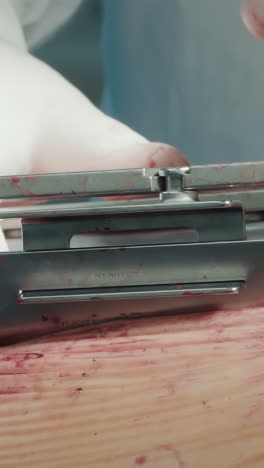 el médico expande el pecho para la cirugía cardíaca. el cirujano utiliza un dilatador para abrir el pecho del paciente asegurando que la herida esté preparada para una cirugía de derivación de la arteria coronaria precisa