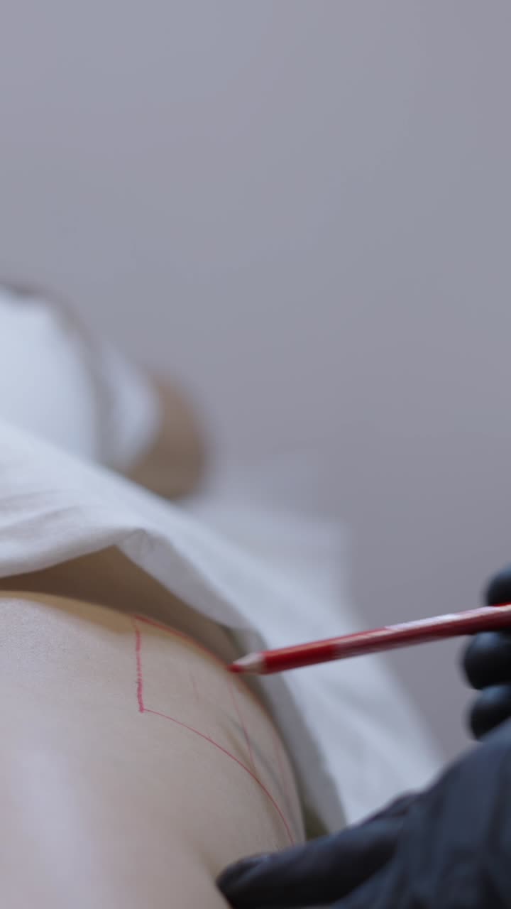 Preparazione per la liposuzione