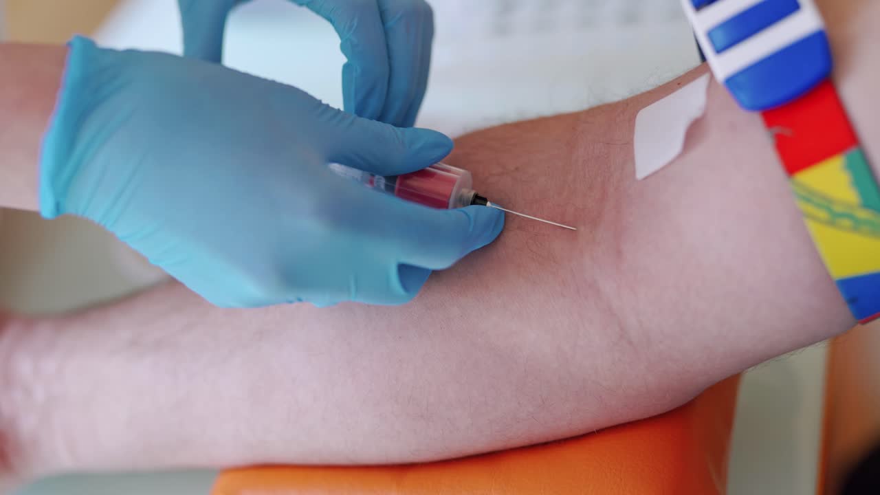 Nurse collecting blood from patient vein into syringe.The process of blood sampling from the vein for examination. Close-up.