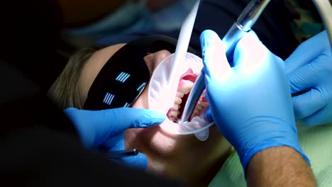 proceso de retiro de brackets