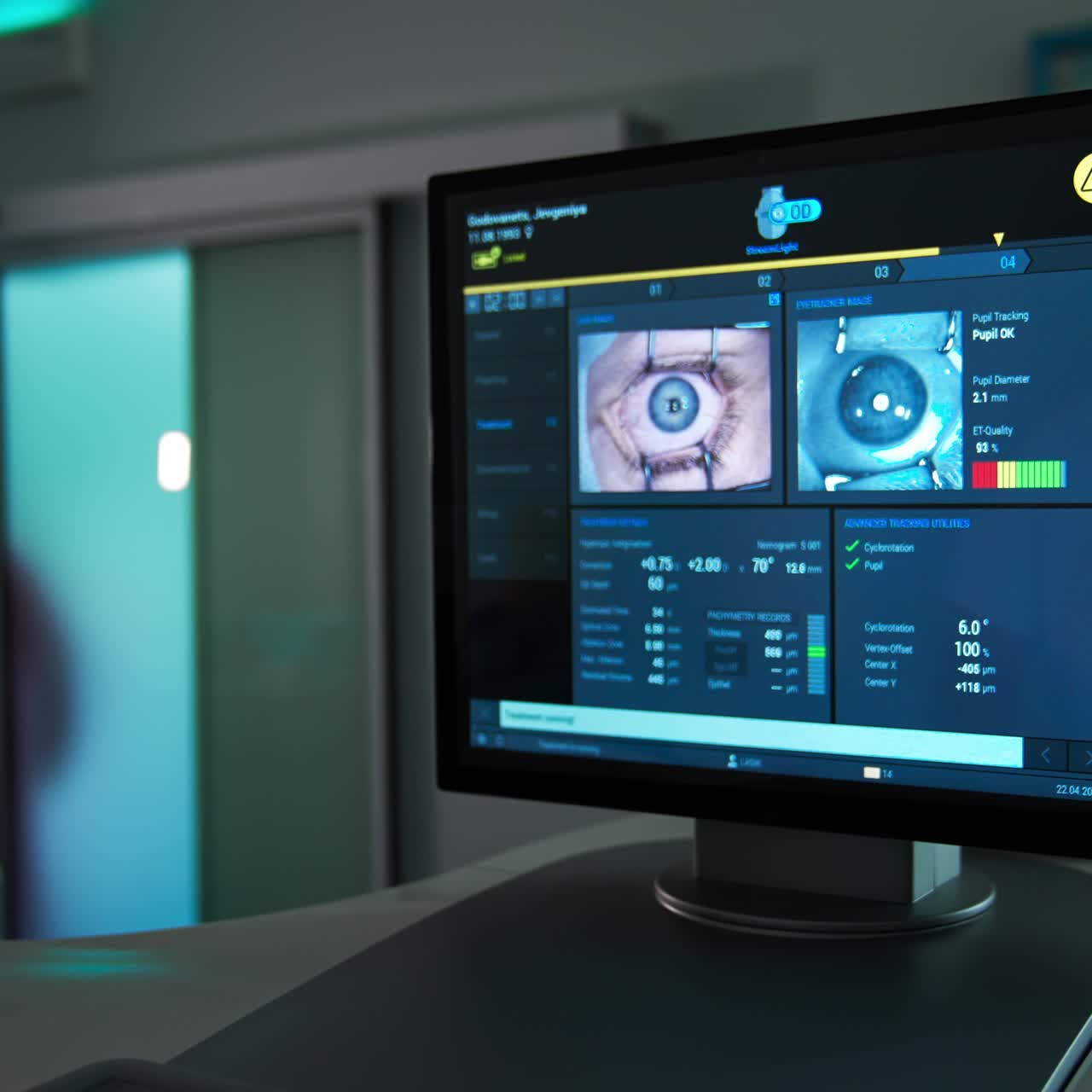 Ophtalmology laser correction. Eye laser correction monitoring