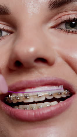 mujer con aparatos dentales limpiando los dientes