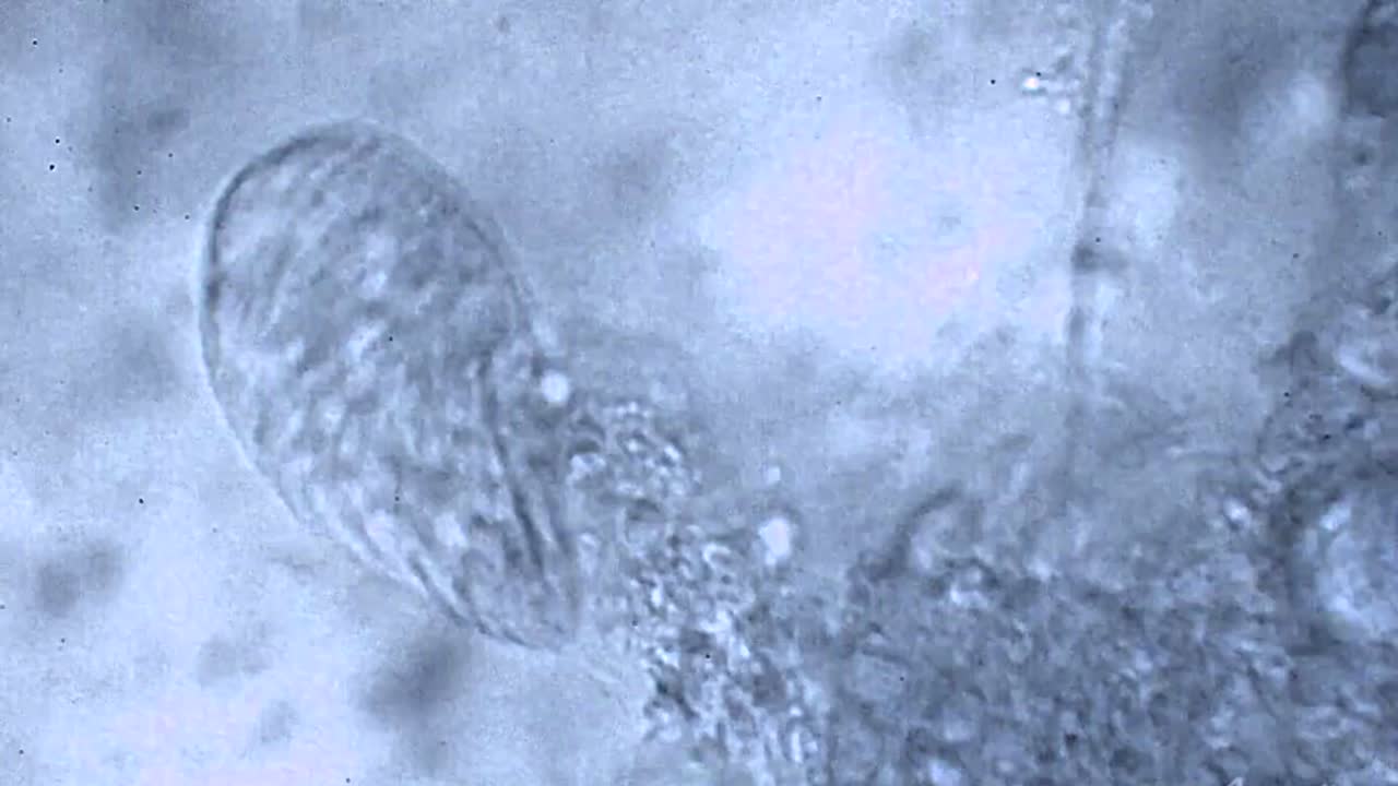 질병 질병 질병 죽음  ⁇ 룩 검은 전염병 죽음 현미경 세균 감염 연구 과학 전염병 전염병 두려움