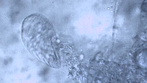 enfermedad enfermedad enfermedad muerte pulgas peste negra muerte gérmenes microscópicos infección investigación ciencia pandemia epidemia miedo