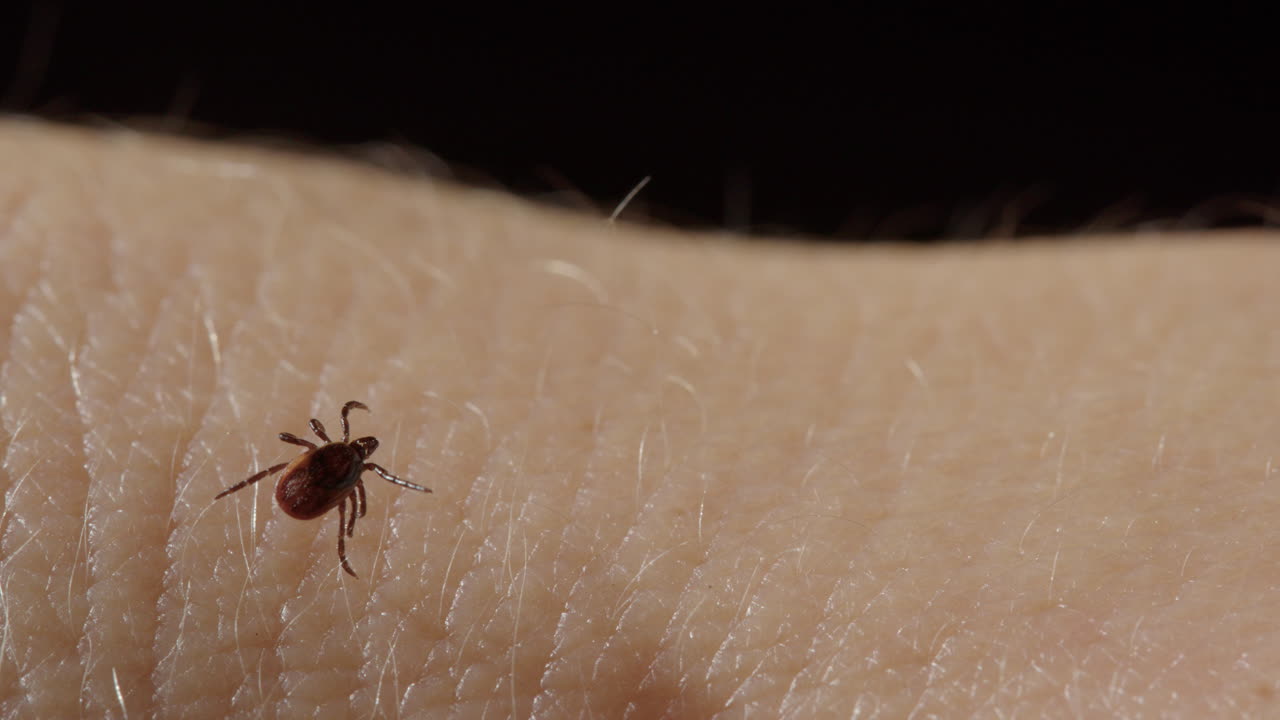 Closeup view of parasitic tick walking over fine hairs on caucasian skin