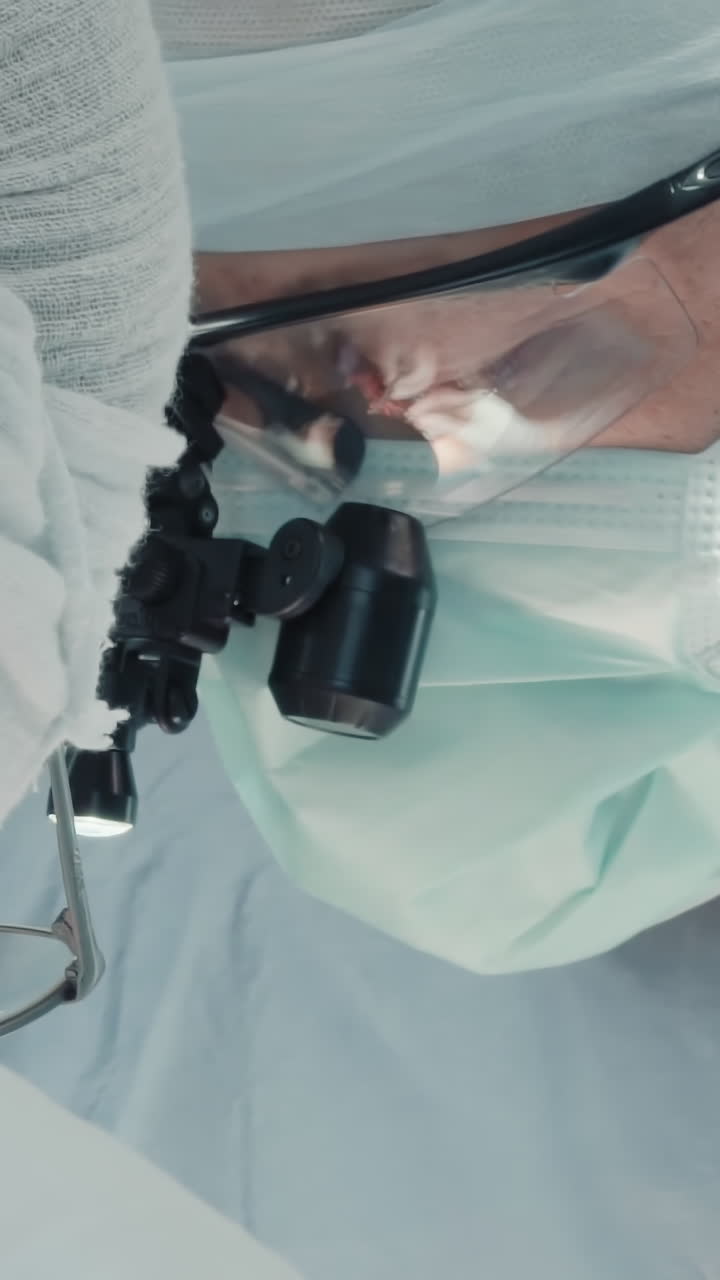 cirujanos con herramientas especializadas operan. médicos cualificados realizan cirugía de trasplante de la arteria coronaria trabajando en arterias pequeñas en la sala de operaciones