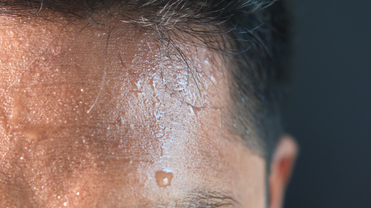 으로 가득 찬 남자의 이마