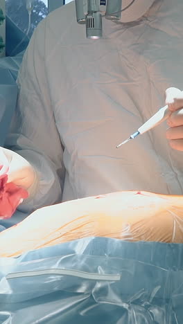 el cirujano corta el pecho del paciente con un bisturí láser en la clínica. médico concentrado con binoculares en cirugía de bypass de la arteria coronaria en el hospital. herramienta médica