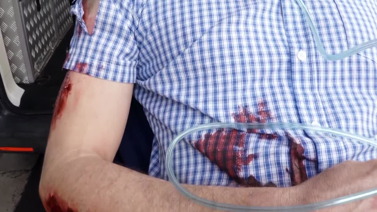 paramédico que utiliza un desfibrilador externo durante la reanimación cardiopulmonar