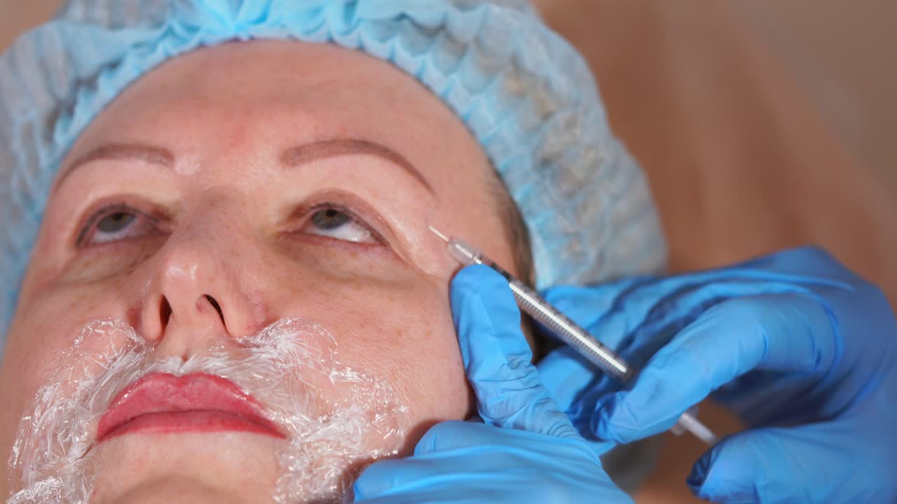 Botox Injection Procedure