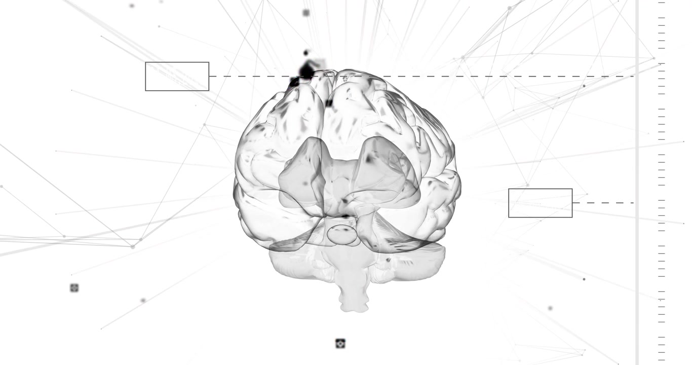 On load 3D brain model rotating revealing structures as data boxes drifting for anatomy view