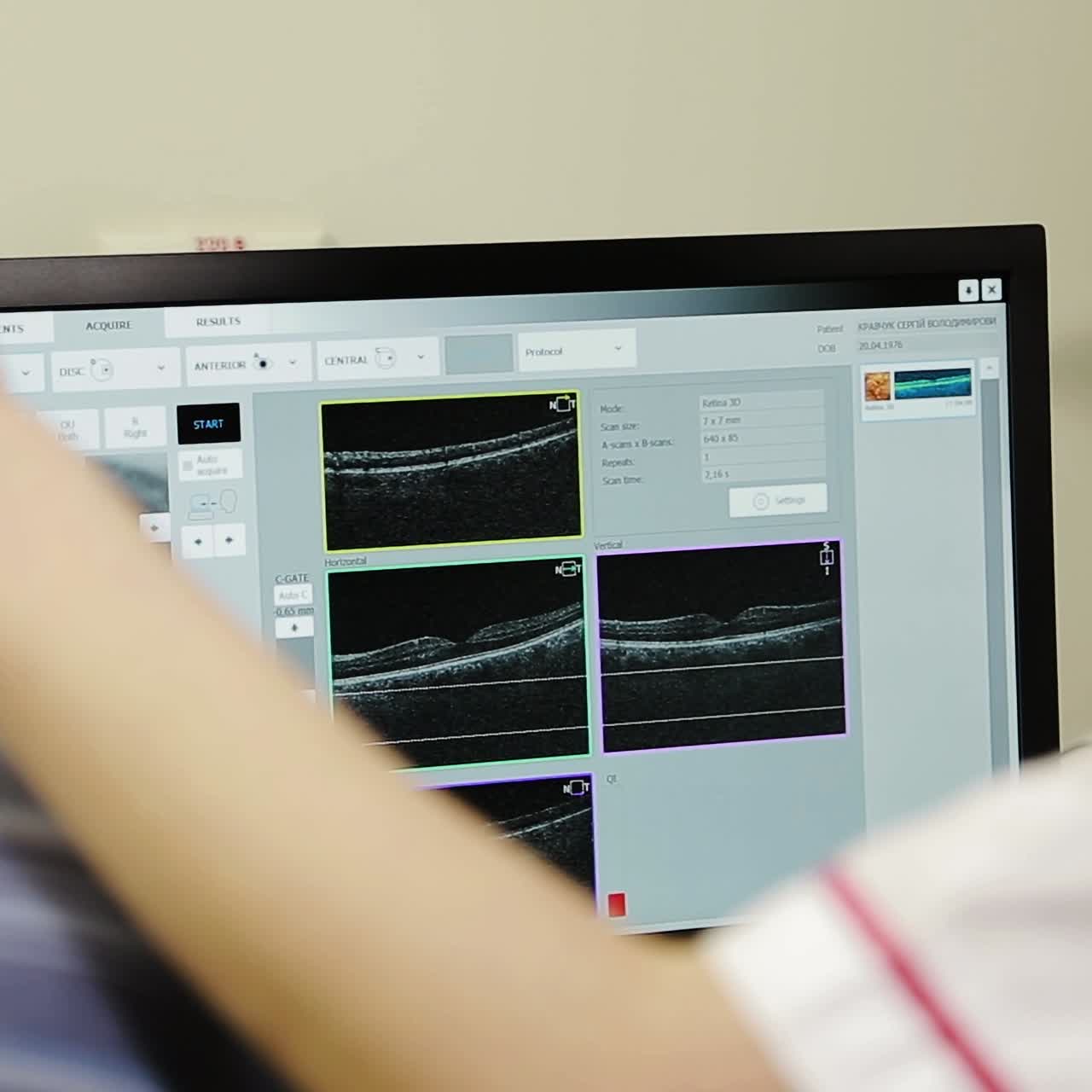 hombre que realiza un examen ocular