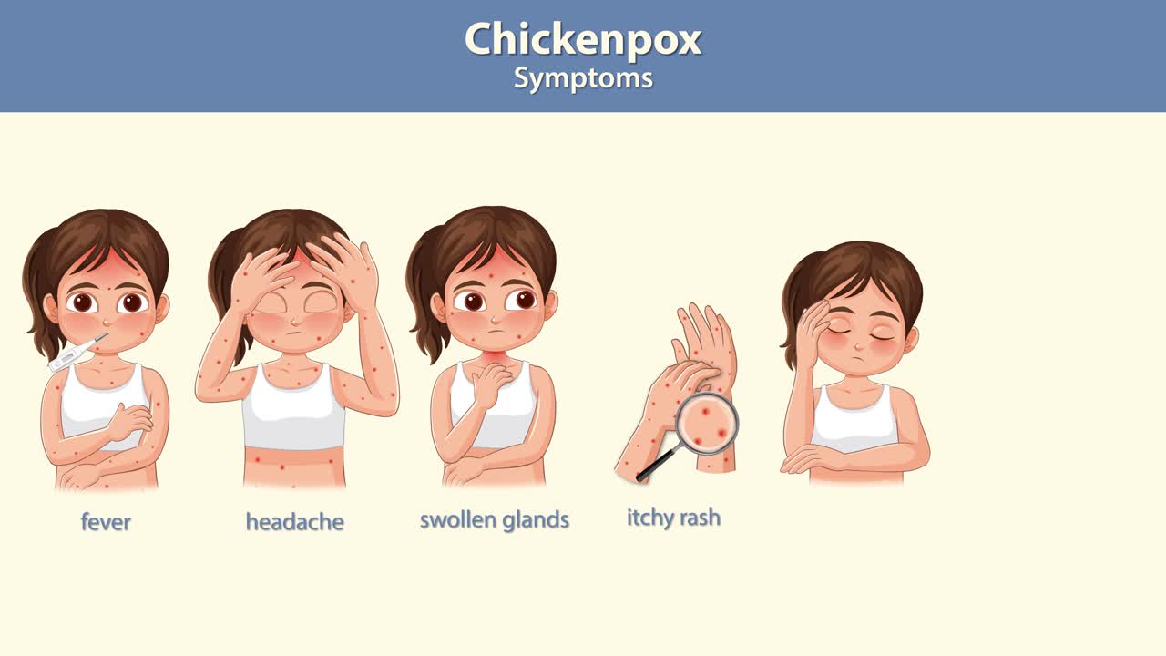 Animated sequence illustrating chickenpox symptoms in a girl, highlighting fever, rash, fatigue, and more