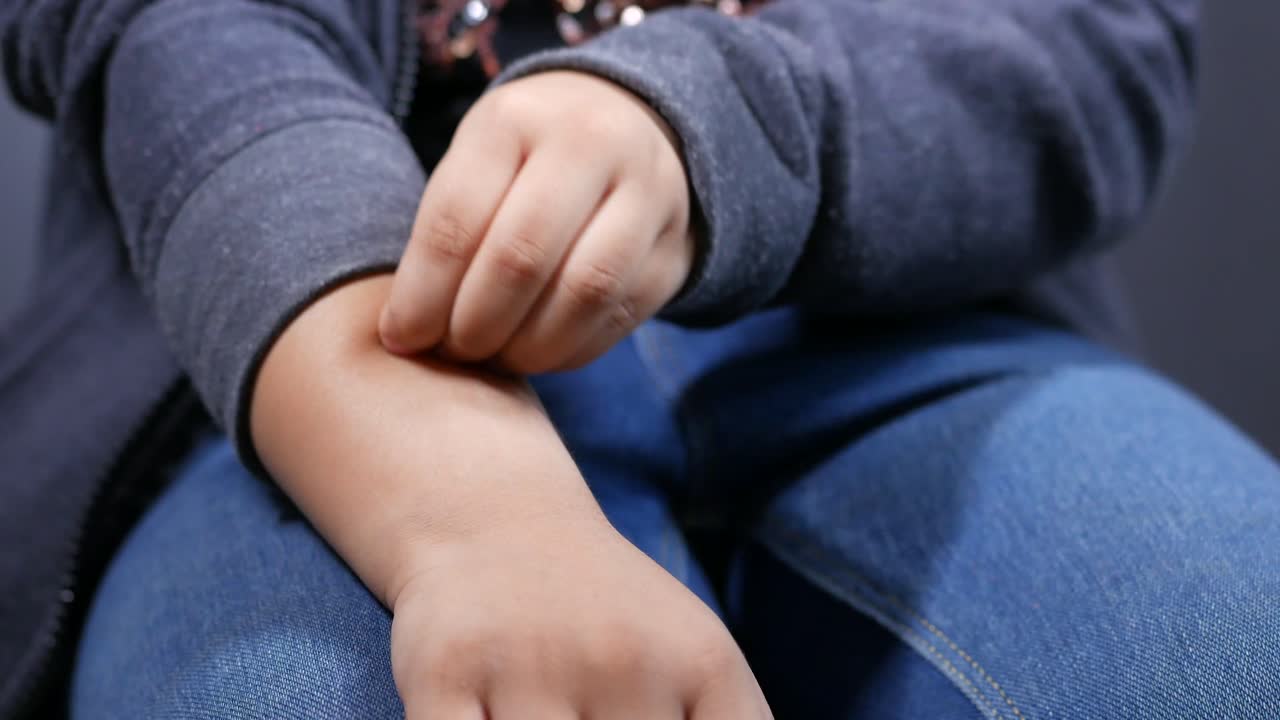 Child scratching arm