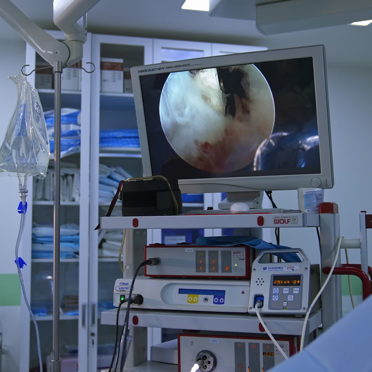 Endoscope technology with monitors equipment