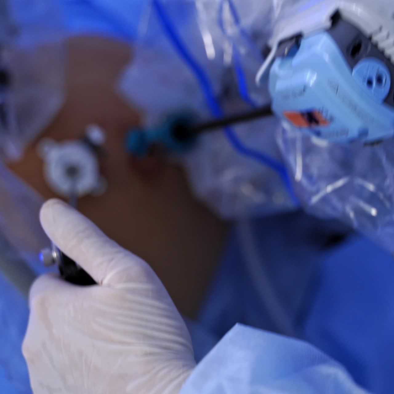 Surgical procedure. Doctor's hand in sterile glove during the robotic surgery. Surgeon perform an operation with modern medical equipment in the hospital. Close-up.