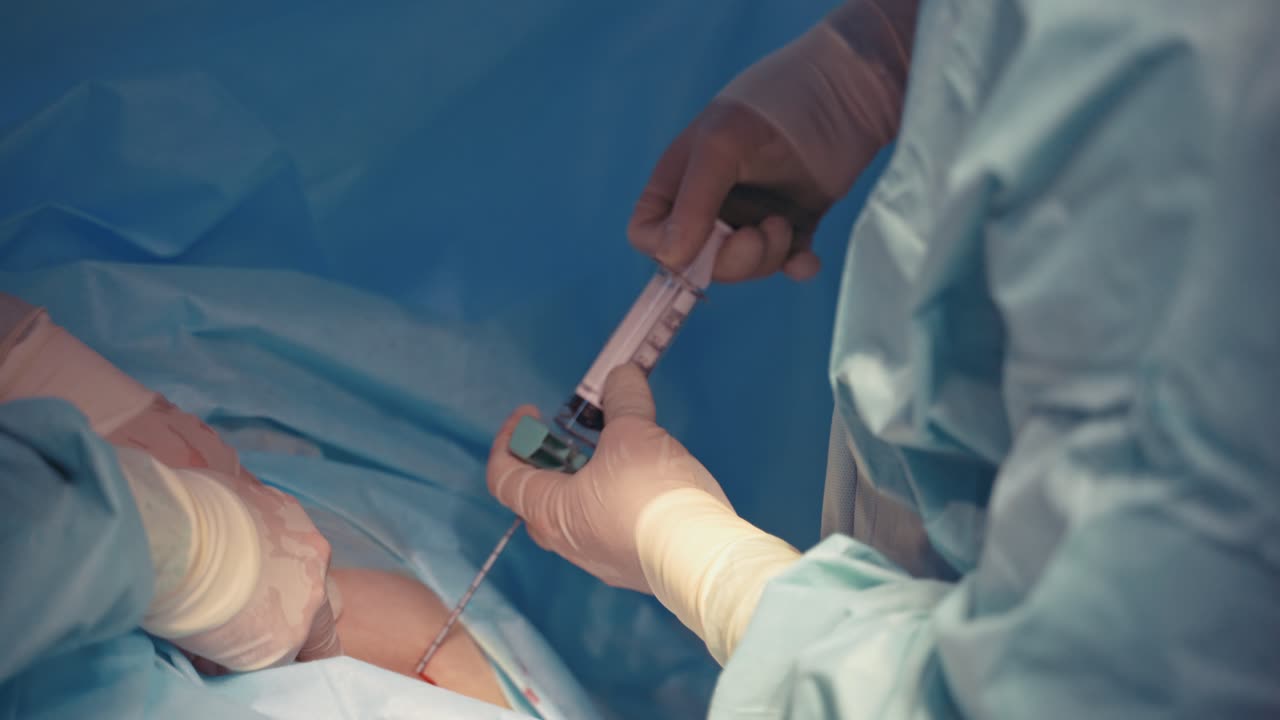 Bone marrow transplant operation. Team surgeons operation bone marrow transplant