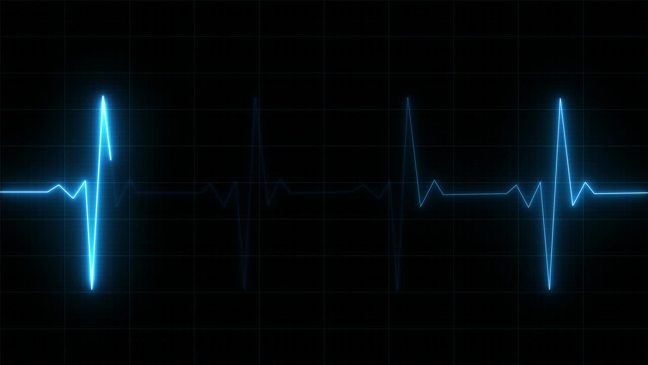 심장 박동 모니터, 심장 전기 그래프 (ecg) 또는 ecg 루핑 배경