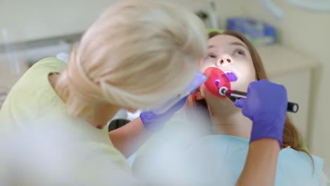 Zahnarzt-Arbeitet-Mit-Einer-Zahnpolymerisationslampe-In-Der-Mundhöhle.-Zahnbehandlung