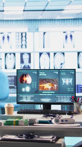 medical diagnosis workstation showing tumor and thyroid images