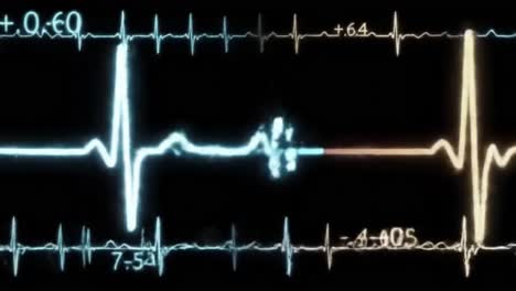 captivating visuals of heartbeat patterns showcased on a medical monitor, highlighting vital signs during an examination in a hospital setting. the colorful display offers insights into heart health.