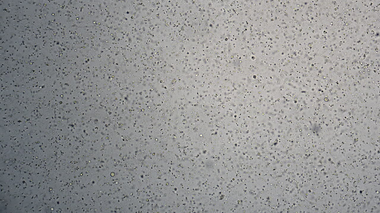 acercar los espermatozoides humanos vistos en microscopía de campo claro