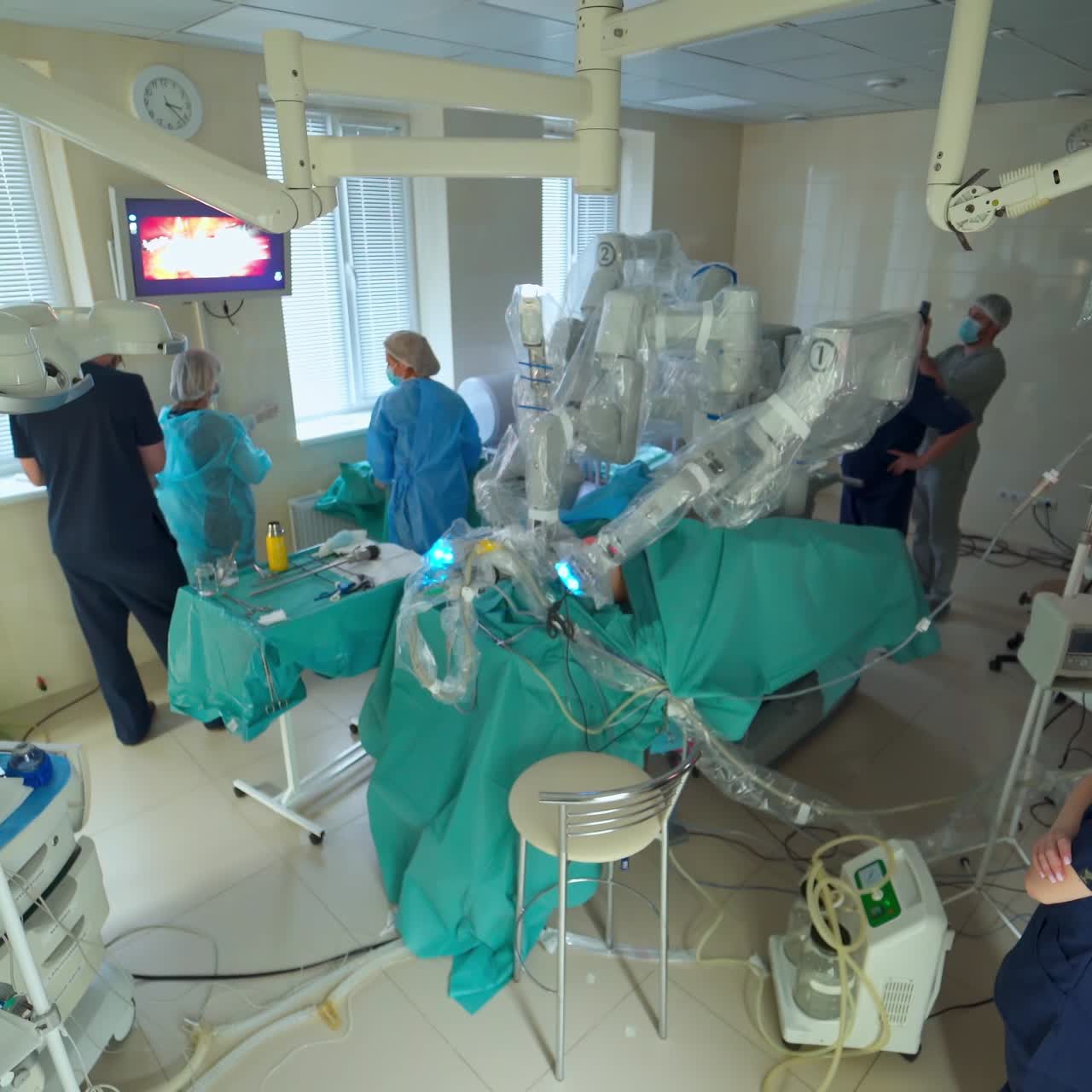 Cirugía robótica mínimamente invasiva. Equipo de cirujanos realizando una operación con el sistema robótico da Vinci.
