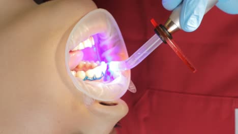 teeth whitening procedure