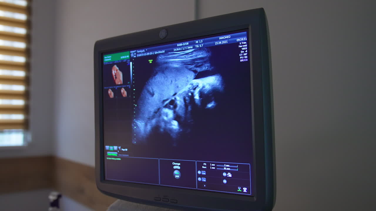 Little baby seen on the screen in mother's womb. Blue monitor showing the child development parameters.