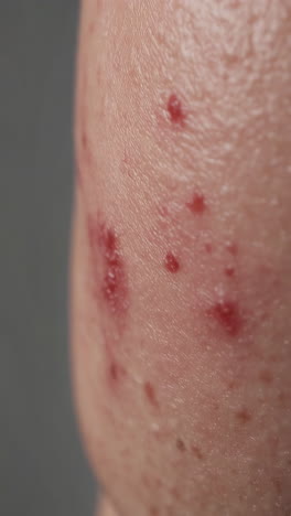 skin rash on the body