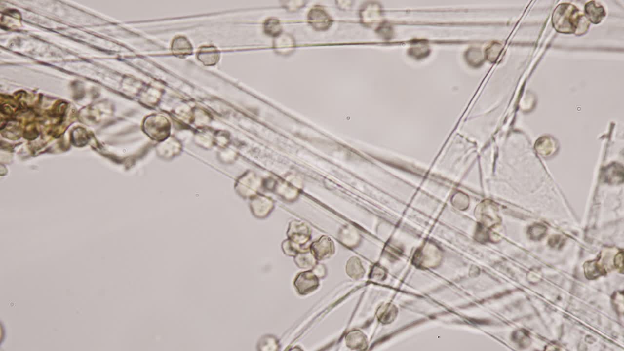molde o moho. molde esporas esféricas de primer plano. reproducción en el reino de los hongos. el hongo crece en forma de filamentos multicelulares llamados hifas. los compuestos tóxicos o micotoxinas son producidos por los moldes. magnificación de 1000x bajo microscopio óptico.