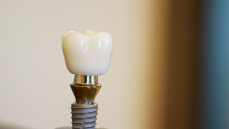 close-up of a dental implant model on display
