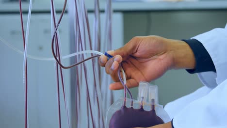 técnico de laboratorio analizando la bolsa de sangre 4k