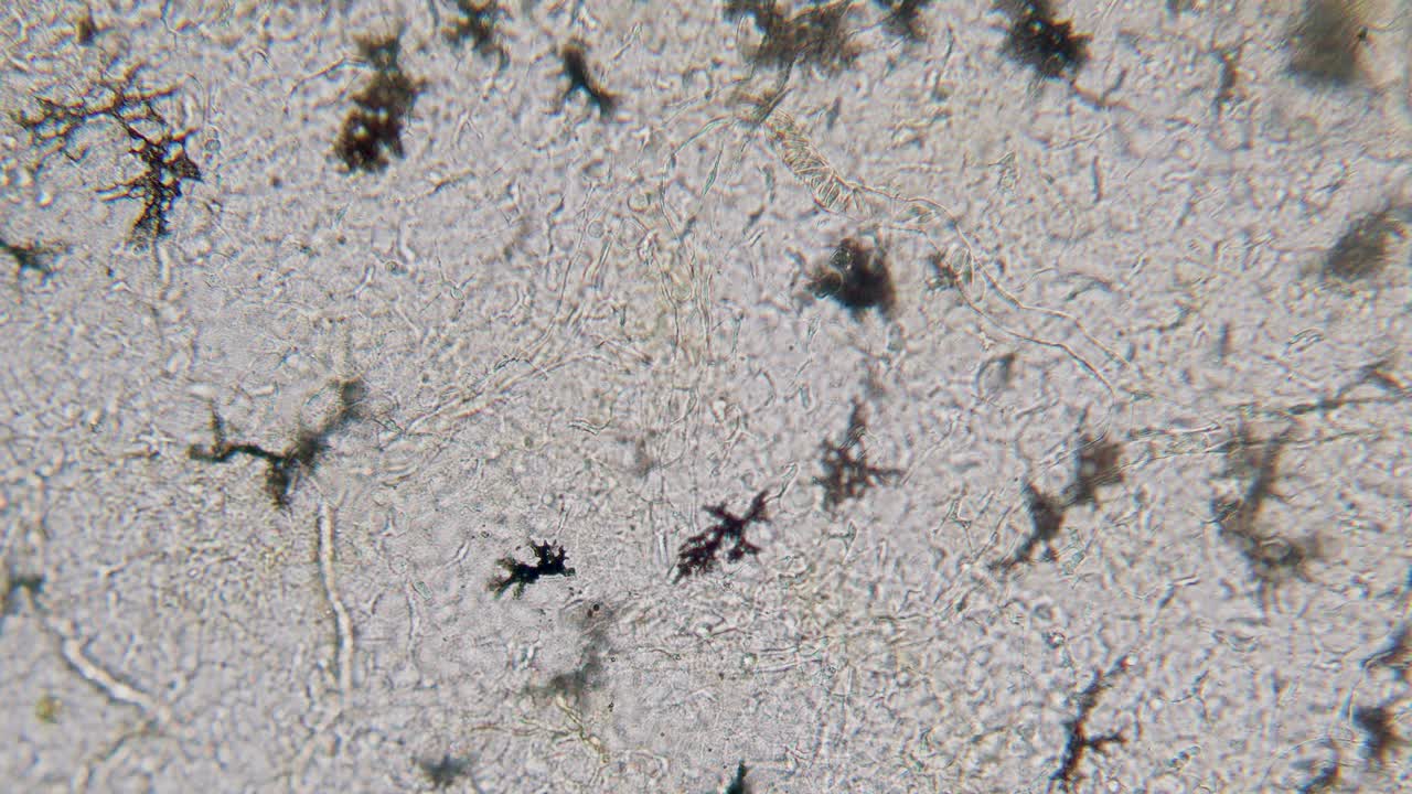 sangre movimiento de eritrocitos en vasos sanguíneos capilares pigmento