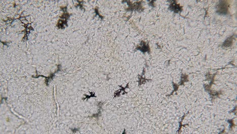 sangre movimiento de eritrocitos en vasos sanguíneos capilares pigmento