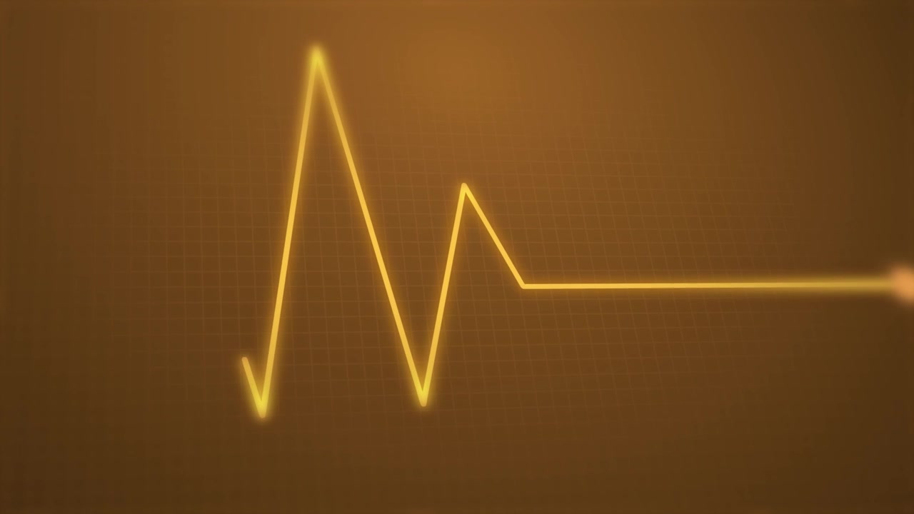 Monitor Cardiaco Animato con Asistolia