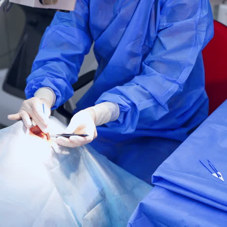 surgeon holding medical instruments in hands and treating patient's eyes with modern microscope. eyesight corrextion.