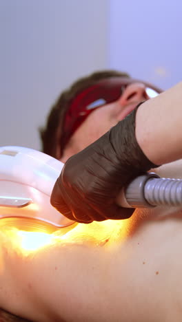 hair removal process on armpit zone. beauty specialist uses laser for elos epilation for a male client. vertical video