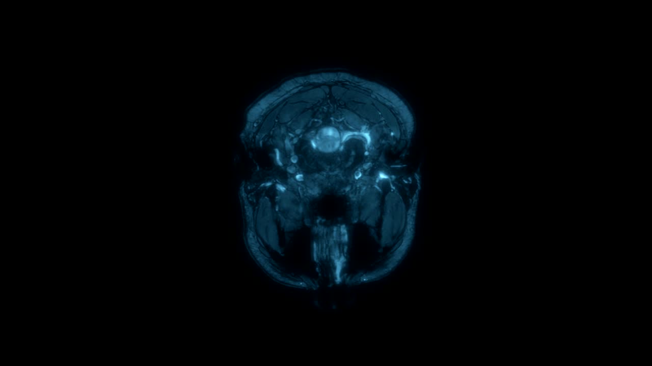 Escáner de Resonancia Magnética (RM) de un cerebro humano, ultra HD 4K, time-lapse. Rayos X, tomografía médica computarizada. Color azul médico.